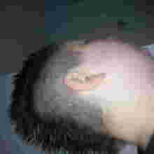 the_onlyone